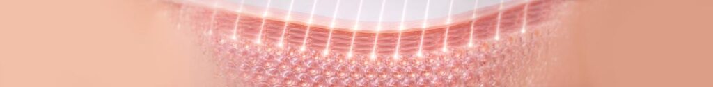 how to repair skin barrier naturally